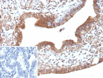 Immunohistochemistry analysis of EGFL7 / EGF-like domain-containing protein 7 antibody in human tonsil. FFPE human tonsil tissue was stained with EGFL7 / EGF-like domain-containing protein 7 antibody (clone EGFL7/9497). HRP-DAB brown chromogenic signal is observed predominantly along the endothelial lining of vascular structures and within the extracellular matrix surrounding vessels, consistent with the known extracellular and endothelial-associated localization of EGFL7. Vascular endothelial cells display membranous and cytoplasmic brown staining, while adjacent lymphoid cells show minimal background signal. Nuclei are counterstained blue. The inset image shows PBS used instead of primary antibody, demonstrating absence of specific HRP-DAB brown staining and confirming staining specificity. Heat-induced epitope retrieval was performed in 10 mM Tris with 1 mM EDTA, pH 9.0, for 45 minutes at 95oC followed by cooling at room temperature for 20 minutes prior to antibody incubation.