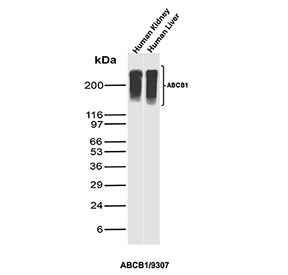 Western blot analysis of MDR1 / Multidrug resistance protein 1 antibody in human tissues. Western blot was performed using MDR1 / Multidrug resistance protein 1 antibody (clone ABCB1/9307) on human kidney and human liver tissue lysates. A prominent immunoreactive band is detected at approximately 170 kDa in both tissues, consistent with the predicted molecular weight of ABCB1, commonly referred to as p170 or P-glycoprotein. The observed band appears slightly diffuse, which is consistent with the heavily glycosylated nature of MDR1 and its membrane-associated localization. The detected signal aligns with the predicted molecular weight under reducing conditions. ABCB1 is highly expressed in epithelial barrier tissues such as kidney proximal tubules and liver canalicular membranes, and the strong band intensity in these samples supports specific detection of endogenous MDR1.