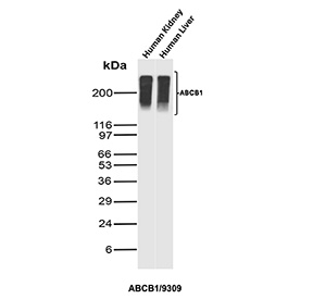 Western blot analysis of CD243 / Multidrug Resistance 1 antibody in human tissues. Western blot was performed using CD243 / Multidrug Resistance 1 antibody (clone ABCB1/9309) on human kidney and human liver tissue lysates. A strong immunoreactive band is detected at approximately 170 kDa in both samples, consistent with the predicted molecular weight of ABCB1, also known as p170 or P-glycoprotein. The band appears broad and slightly diffuse, which is consistent with the extensively glycosylated nature of Multidrug Resistance 1 and its membrane-associated processing. The detected signal corresponds to the predicted molecular weight under reducing conditions. ABCB1 is physiologically enriched in kidney proximal tubules and liver canalicular membranes, and the prominent band intensity in these tissues supports specific detection of endogenous CD243.