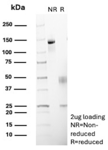 SDS-PAGE Analysis of Purified Serpin B5/Mammary Protease Inhibitor antibody (clone SERPINB5/12555). Confirmation of Purity and Integrity of Antibody.