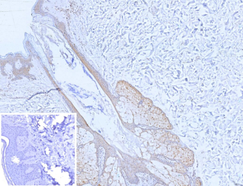 Immunohistochemistry analysis of Mammary Serine Protease Inhibitor / MASPIN antibody (clone SERPINB5/12556) in human skin tissue. FFPE human skin shows HRP-DAB brown staining predominantly in epidermal keratinocytes with both nuclear and cytoplasmic localization, consistent with epithelial expression of SERPINB5. Dermal stromal cells are largely negative. The inset image shows PBS used instead of primary antibody as a negative control. Heat induced epitope retrieval was performed in 10mM Tris with 1mM EDTA, pH 9.0, for 45 minutes at 95oC followed by cooling before staining.