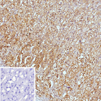 Immunohistochemistry analysis of PI5 / SERPINB5 antibody (clone SERPINB5/12558) in human adrenal gland tissue. Sections of formalin-fixed, paraffin-embedded human adrenal gland show cytoplasmic and membranous brown chromogenic staining in adrenal cortical cells, while nuclei are counterstained blue. The inset image represents a negative control in which PBS was used instead of the primary antibody, demonstrating absence of specific staining. Heat induced epitope retrieval was performed by boiling tissue sections in 10mM Tris with 1mM EDTA, pH 9.0, for 45 minutes at 95oC followed by cooling at room temperature for 20 minutes before immunostaining.