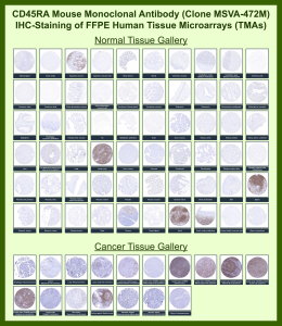 Immunohistochemistry analysis of PTPRC/CD45RA antibody (clone MSVA-472M) in human normal and cancer tissue microarrays. Representative FFPE human tissues demonstrate expected membranous staining of lymphoid cells in tonsil, spleen, thymus, and lymph node, with minimal staining in most non-hematopoietic tissues. In cancer specimens, strong membranous positivity is observed in CD45RA-positive lymphoid malignancies, while non-lymphoid tumors show little to no staining. Staining patterns are consistent with the known distribution of Receptor-type tyrosine-protein phosphatase C and align with publicly available expression data for PTPRC. 