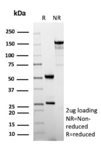 SDS-PAGE Analysis of Purified CXCR5 Mouse Monoclonal Antibody (CXCR5/13099). Confirmation of Purity and Integrity of Antibody.