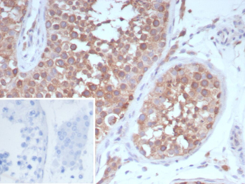 Immunohistochemistry analysis of Angiopoietin Receptor / TIE2 antibody in human testis tissue (clone TEK/9412). FFPE human testis sections demonstrate HRP-DAB brown cytoplasmic and membranous staining within cells of the seminiferous tubules, with additional signal highlighting vascular endothelial cells in the interstitial spaces. The staining pattern is consistent with TEK receptor tyrosine kinase localization, showing membranous accentuation and diffuse cytoplasmic positivity in endothelial-associated structures. The inset shows PBS used in place of primary antibody as a secondary antibody negative control, confirming absence of specific brown chromogenic signal. Heat induced epitope retrieval was performed in 10 mM Tris with 1 mM EDTA, pH 9.0, by heating tissue sections at 95oC for 45 minutes followed by cooling at room temperature for 20 minutes prior to antibody incubation.