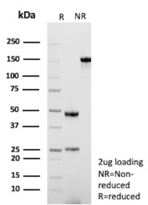 SDS-PAGE Analysis of Purified Transforming growth factor beta 1/TGFB1 antibody (clone rTGFB17). Confirmation of Purity and Integrity of Antibody.