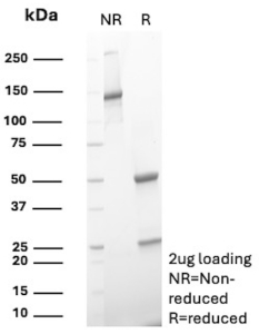 SDS-PAGE Analysis of Purified p53 Recombinant Mouse Monoclonal Antibody (rIMX25). Confirmation of Purity and Integrity of Antibody.