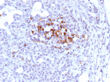 Formalin-fixed, paraffin-embedded human tonsil stained with Complement Component C9 Recombinant Mouse Monoclonal Antibody (r10A6). Inset: PBS instead of primary antibody; secondary only negative control.