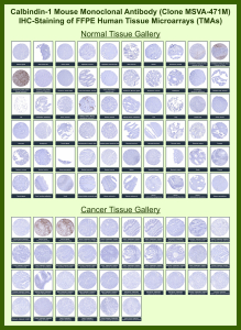 Immunohistochemistry analysis of Calbindin-D28k/CALB1 antibody (clone MSVA-471M) in human tissue microarrays. Formalin-fixed, paraffin-embedded normal and cancer tissues demonstrate strong cytoplasmic HRP-DAB brown staining in cerebellar Purkinje cells and select renal tubular epithelial cells, while most other normal tissues show low or absent staining. In cancer specimens, the majority of tumor types display negative or weak staining, consistent with restricted physiologic expression patterns. The observed staining distribution aligns with publicly available expression data, supporting selective detection of CALB1 in tissues known to express Calbindin.