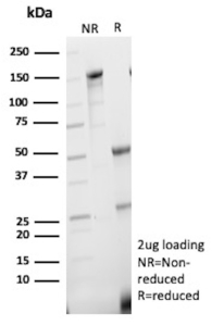 SDS-PAGE Analysis of Purified NANOG Mouse Monoclonal Antibody (NANOG/9704). Confirmation of Purity and Integrity of Antibody.