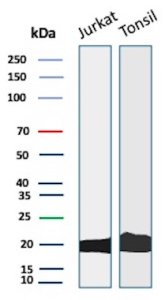 Western blot analysis of Jurkat cell lysate and human tonsil tissue lysate using CD3D Rabbit Recombinant Monoclonal Antibody (CD3D/13089R).