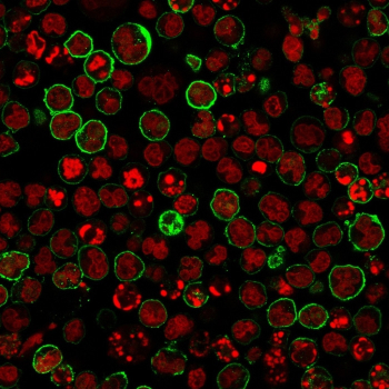 Immunofluorescence analysis of MS4A1 Antibody in human Raji cells. MS4A1/Membrane spanning 4-domains A1 antibody (clones L26 + IGEL/773) followed by goat anti-mouse IgG-CF488 demonstrates distinct green membranous staining outlining CD20-positive B cells, consistent with MS4A1 surface localization, while nuclei are counterstained with Reddot (red). The staining pattern highlights strong plasma membrane expression with minimal cytoplasmic background, supporting specific detection of CD20 in this B-cell derived line.