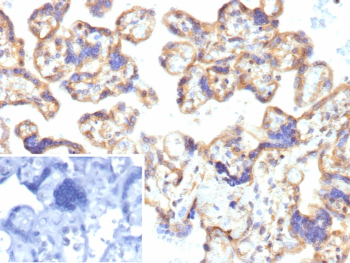 IHC analysis of ENTPD1 Antibody in FFPE human placenta tissue. The recombinant mouse monoclonal antibody (clone r22A9) demonstrates membranous HRP-DAB brown staining in trophoblastic cells lining chorionic villi, consistent with CD39 / ENTPD1 expression, while background stromal elements show minimal staining. The inset shows PBS used in place of the primary antibody as a secondary-only negative control. Heat-induced epitope retrieval was performed in 10mM Tris with 1mM EDTA, pH 9.0, at 95oC for 45 minutes followed by cooling at room temperature for 20 minutes.