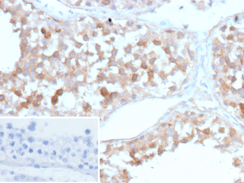 Immunohistochemistry of SV2 Protein antibody in human testis tissue. FFPE human testis demonstrates cytoplasmic HRP-DAB brown staining within seminiferous tubule cells, consistent with Synaptic vesicle protein 2A localization in vesicular and secretory compartments. Clone r15E11 was used as a recombinant mouse monoclonal antibody for detection. The inset shows PBS in place of primary antibody as a negative control with absence of specific staining. Heat-induced epitope retrieval was performed by heating tissue sections in 10 mM Tris with 1 mM EDTA, pH 9.0, at 95C for 45 minutes followed by cooling at room temperature for 20 minutes prior to staining.