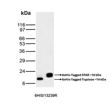 Western blot analysis of 6xHis Tag Antibody in recombinant protein samples. Multiple epitope-tagged recombinant proteins containing V5, FLAG, HA, and His sequences were resolved by SDS-PAGE under reducing conditions and probed with 6xHis Tag Antibody clone 6HIS/13239R. Distinct immunoreactive bands are observed at approximately 18 kDa and 14 kDa, corresponding to 6xHis-tagged STAR and 6xHis-tagged tryptase proteins, respectively, as indicated. The selective detection of the His-tagged constructs demonstrates specific recognition of the His epitope tag by clone 6HIS/13239R without cross-reactivity to non-His epitope tags present in the samples.