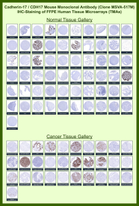 Cadherin-17 Mouse Monoclonal Antibody (MSVA-517M) tested on many normal and cancer tissues. The immunohistochemistry staining in these tissues aligns with the expression data in Human Protein Atlas. <br><br>Manual Protocol: Freshly cut sections should be used (less than 10 days between cutting and staining). Heat-induced antigen retrieval for 5 minutes in an autoclave at 121oC in pH 7.8 Target Retrieval Solution buffer. Apply the antibody at a dilution of 1:150 at 37oC for 60 minutes. Visualization of bound antibody by the EnVision Kit (Dako, Agilent) according to the manufacturer's directions.