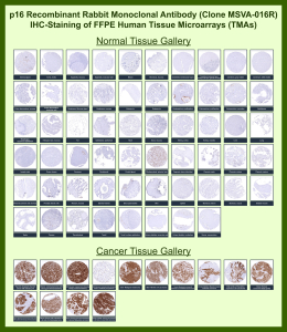 p16 INK4a/CDKN2A antibody (clone MSVA-016R) tested on many normal and cancer tissues. The immunohistochemistry staining in these tissues aligns with the expression data in Human Protein Atlas. <BR>Manual Protocol: Freshly cut sections should be used (less than 10 days between cutting and staining). Heat-induced antigen retrieval for 5 minutes in an autoclave at 121oC in pH 7.8 Target Retrieval Solution buffer. Apply the antibody at a dilution of 1:150 at 37oC for 60 minutes. Visualization of bound antibody by the EnVision Kit (Dako, Agilent) according to the manufacturer's directions.