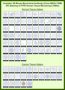 Uroplakin-3b Mouse Monoclonal Antibody (MSVA-736M) tested on many normal and cancer tissues. The immunohistochemistry staining in these tissues aligns with the expression data in Human Protein Atlas. <br><br>Manual Protocol: Freshly cut sections should be used (less than 10 days between cutting and staining). Heat-induced antigen retrieval for 5 minutes in an autoclave at 121oC in pH 7.8 Target Retrieval Solution buffer. Apply the antibody at a dilution of 1:150 at 37oC for 60 minutes. Visualization of bound antibody by the EnVision Kit (Dako, Agilent) according to the manufacturer's directions.