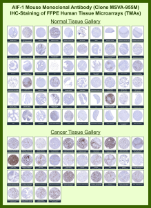Allograft inflammatory factor 1 Mouse Monoclonal Antibody (MSVA-955M) tested on many normal and cancer tissues. The immunohistochemistry staining in these tissues aligns with the expression data in Human Protein Atlas. <br><br>Manual Protocol: Freshly cut sections should be used (less than 10 days between cutting and staining). Heat-induced antigen retrieval for 5 minutes in an autoclave at 121oC in pH 7.8 Target Retrieval Solution buffer. Apply the antibody at a dilution of 1:150 at 37oC for 60 minutes. Visualization of bound antibody by the EnVision Kit (Dako, Agilent) according to the manufacturer's directions.