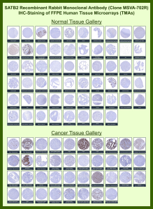 DNA-binding protein SATB2 Rabbit Recombinant Monoclonal Antibody (MSVA-702R) tested on many normal and cancer tissues. The immunohistochemistry staining in these tissues aligns with the expression data in Human Protein Atlas. <br><br>Manual Protocol: Freshly cut sections should be used (less than 10 days between cutting and staining). Heat-induced antigen retrieval for 5 minutes in an autoclave at 121oC in pH 7.8 Target Retrieval Solution buffer. Apply the antibody at a dilution of 1:150 at 37oC for 60 minutes. Visualization of bound antibody by the EnVision Kit (Dako, Agilent) according to the manufacturer's directions.