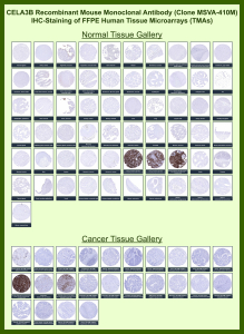 Chymotrypsin-like elastase family member 3B Mouse Recombinant Monoclonal Antibody (MSVA-410M) tested on many normal and cancer tissues. The immunohistochemistry staining in these tissues aligns with the expression data in Human Protein Atlas. <br><br>Manual Protocol: Freshly cut sections should be used (less than 10 days between cutting and staining). Heat-induced antigen retrieval for 5 minutes in an autoclave at 121oC in pH 7.8 Target Retrieval Solution buffer. Apply the antibody at a dilution of 1:150 at 37oC for 60 minutes. Visualization of bound antibody by the EnVision Kit (Dako, Agilent) according to the manufacturer's directions.