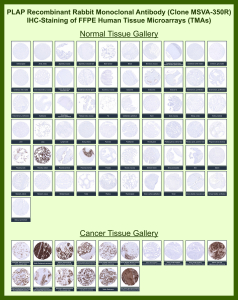 Alkaline phosphatase, placental type Rabbit Recombinant Monoclonal Antibody (MSVA-350R) tested on many normal and cancer tissues. The immunohistochemistry staining in these tissues aligns with the expression data in Human Protein Atlas. <br><br>Manual Protocol: Freshly cut sections should be used (less than 10 days between cutting and staining). Heat-induced antigen retrieval for 5 minutes in an autoclave at 121oC in pH 7.8 Target Retrieval Solution buffer. Apply the antibody at a dilution of 1:150 at 37oC for 60 minutes. Visualization of bound antibody by the EnVision Kit (Dako, Agilent) according to the manufacturer's directions.