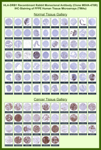 HLA class II histocompatibility antigen, DRB1 beta chain Rabbit Recombinant Monoclonal Antibody (MSVA-478R) tested on many normal and cancer tissues. The immunohistochemistry staining in these tissues aligns with the expression data in Human Protein Atlas. <br><br>Manual Protocol: Freshly cut sections should be used (less than 10 days between cutting and staining). Heat-induced antigen retrieval for 5 minutes in an autoclave at 121oC in pH 7.8 Target Retrieval Solution buffer. Apply the antibody at a dilution of 1:150 at 37oC for 60 minutes. Visualization of bound antibody by the EnVision Kit (Dako, Agilent) according to the manufacturer's directions.