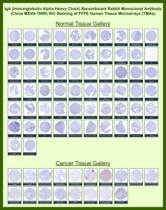 IHC IGHA Antibody for IHC Clone MSVA-700R in human tissue microarrays. Immunohistochemistry analysis of IGHA Antibody for IHC Clone MSVA-700R in formalin-fixed paraffin-embedded human normal and cancer tissue microarrays. The recombinant rabbit monoclonal antibody highlights IgA-producing plasma cells with HRP-DAB brown cytoplasmic staining, consistent with expression of Immunoglobulin alpha heavy chain (IGHA), the heavy chain component of IgA antibodies. Positive plasma cell staining is most prominent in lymphoid and mucosa-associated tissues such as tonsil, gastrointestinal mucosa, and lymph node, reflecting the physiological distribution of IgA-secreting plasma cells in mucosal immunity. Many non-lymphoid tissues show minimal staining except for scattered plasma cells within stromal or inflammatory compartments. The observed staining pattern across normal and tumor tissues is consistent with reported IGHA expression profiles in the Human Protein Atlas.