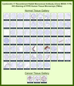 Cytokeratin 17 Antibody for IHC (clone MSVA-117R) immunohistochemistry analysis in human tissue microarrays. Immunohistochemistry staining of formalin-fixed, paraffin-embedded human tissue microarrays using the recombinant rabbit monoclonal Cytokeratin 17 Antibody for IHC (clone MSVA-117R) demonstrates epithelial cytoplasmic HRP-DAB brown chromogenic staining in CK17-expressing tissues. Staining highlights epithelial structures such as basal epithelial layers and glandular epithelial compartments consistent with known cytokeratin 17 distribution. Cancer tissue array analysis shows CK17-positive tumor epithelial cells in selected carcinomas. The immunohistochemistry staining patterns across normal and tumor tissues align with cytokeratin 17 expression data reported in the Human Protein Atlas.