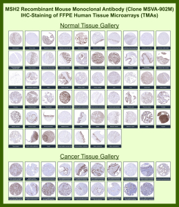 DNA mismatch repair protein Msh2 Mouse Recombinant Monoclonal Antibody (MSVA-902M) tested on many normal and cancer tissues. The immunohistochemistry staining in these tissues aligns with the expression data in Human Protein Atlas. <br><br>Manual Protocol: Freshly cut sections should be used (less than 10 days between cutting and staining). Heat-induced antigen retrieval for 5 minutes in an autoclave at 121oC in pH 7.8 Target Retrieval Solution buffer. Apply the antibody at a dilution of 1:150 at 37oC for 60 minutes. Visualization of bound antibody by the EnVision Kit (Dako, Agilent) according to the manufacturer's directions.