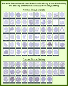 Nucleolin Rabbit Recombinant Monoclonal Antibody (MSVA-623R) tested on many normal and cancer tissues. The immunohistochemistry staining in these tissues aligns with the expression data in Human Protein Atlas. <br><br>Manual Protocol: Freshly cut sections should be used (less than 10 days between cutting and staining). Heat-induced antigen retrieval for 5 minutes in an autoclave at 121oC in pH 7.8 Target Retrieval Solution buffer. Apply the antibody at a dilution of 1:150 at 37oC for 60 minutes. Visualization of bound antibody by the EnVision Kit (Dako, Agilent) according to the manufacturer's directions.
