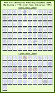 PAX6 Antibody for IHC immunohistochemistry analysis of human tissue microarrays. PAX6 Antibody for IHC (clone MSVA-706M) was tested on a wide panel of normal and cancer tissues. Nuclear HRP-DAB chromogenic staining identifies Pax-6 expressing cells, with strongest signal observed in pancreatic endocrine cells within islets. The immunohistochemistry staining patterns across tissues are consistent with expression data reported in the Human Protein Atlas.