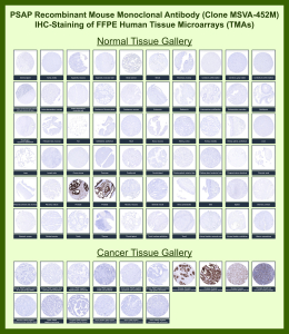 Prostatic acid phosphatase Mouse Recombinant Monoclonal Antibody (MSVA-452M) tested on many normal and cancer tissues. The immunohistochemistry staining in these tissues aligns with the expression data in Human Protein Atlas. <br><br>Manual Protocol: Freshly cut sections should be used (less than 10 days between cutting and staining). Heat-induced antigen retrieval for 5 minutes in an autoclave at 121oC in pH 7.8 Target Retrieval Solution buffer. Apply the antibody at a dilution of 1:150 at 37oC for 60 minutes. Visualization of bound antibody by the EnVision Kit (Dako, Agilent) according to the manufacturer's directions.