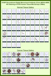 Protein S100-P Rabbit Recombinant Monoclonal Antibody (MSVA-480R) tested on many normal and cancer tissues. The immunohistochemistry staining in these tissues aligns with the expression data in Human Protein Atlas. <br><br>Manual Protocol: Freshly cut sections should be used (less than 10 days between cutting and staining). Heat-induced antigen retrieval for 5 minutes in an autoclave at 121oC in pH 7.8 Target Retrieval Solution buffer. Apply the antibody at a dilution of 1:150 at 37oC for 60 minutes. Visualization of bound antibody by the EnVision Kit (Dako, Agilent) according to the manufacturer's directions.