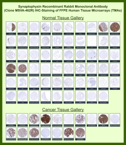 Synaptophysin Rabbit Recombinant Monoclonal Antibody (MSVA-462R) tested on many normal and cancer tissues. The immunohistochemistry staining in these tissues aligns with the expression data in Human Protein Atlas. <br><br>Manual Protocol: Freshly cut sections should be used (less than 10 days between cutting and staining). Heat-induced antigen retrieval for 5 minutes in an autoclave at 121oC in pH 7.8 Target Retrieval Solution buffer. Apply the antibody at a dilution of 1:150 at 37oC for 60 minutes. Visualization of bound antibody by the EnVision Kit (Dako, Agilent) according to the manufacturer's directions.