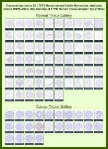 Transcription factor E3 Rabbit Recombinant Monoclonal Antibody (MSVA-403R) tested on many normal and cancer tissues. The immunohistochemistry staining in these tissues aligns with the expression data in Human Protein Atlas. <br><br>Manual Protocol: Freshly cut sections should be used (less than 10 days between cutting and staining). Heat-induced antigen retrieval for 5 minutes in an autoclave at 121oC in pH 7.8 Target Retrieval Solution buffer. Apply the antibody at a dilution of 1:150 at 37oC for 60 minutes. Visualization of bound antibody by the EnVision Kit (Dako, Agilent) according to the manufacturer's directions.
