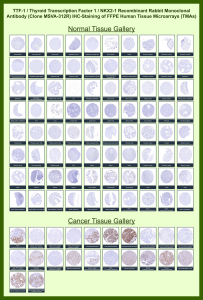 NKX2.1 Antibody for IHC Tissue Microarray (TMA). Immunohistochemistry analysis of NK2 homeobox 1 NKX2-1, also known as TTF-1, in formalin-fixed paraffin-embedded human normal and cancer tissue microarrays using recombinant rabbit monoclonal NKX2.1 antibody clone MSVA-312R. Tissue microarray (TMA) staining with HRP-DAB brown chromogen demonstrates strong nuclear localization in pulmonary epithelial lineage cells, including lung respiratory epithelium, and in thyroid follicular epithelial cells, while most other tissues remain largely negative. Within tumor tissue microarrays, robust nuclear staining is observed in lung adenocarcinoma and other pulmonary epithelial tumors, supporting its use as a pulmonary epithelial marker and diagnostic indicator of tumors of lung origin. Evaluation across large TMA panels enables direct comparison of NKX2-1 expression across diverse tissue types under standardized conditions. The observed staining patterns align with reported NKX2-1 expression profiles in the Human Protein Atlas.