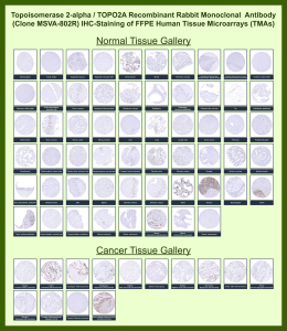 DNA topoisomerase 2-alpha Rabbit Recombinant Monoclonal Antibody (MSVA-802R) tested on many normal and cancer tissues. The immunohistochemistry staining in these tissues aligns with the expression data in Human Protein Atlas. <br><br>Manual Protocol: Freshly cut sections should be used (less than 10 days between cutting and staining). Heat-induced antigen retrieval for 5 minutes in an autoclave at 121oC in pH 7.8 Target Retrieval Solution buffer. Apply the antibody at a dilution of 1:150 at 37oC for 60 minutes. Visualization of bound antibody by the EnVision Kit (Dako, Agilent) according to the manufacturer's directions.