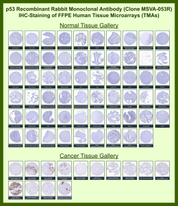 Cellular tumor antigen p53 Rabbit Recombinant Monoclonal Antibody (MSVA-053R) tested on many normal and cancer tissues. The immunohistochemistry staining in these tissues aligns with the expression data in Human Protein Atlas. <br><br>Manual Protocol: Freshly cut sections should be used (less than 10 days between cutting and staining). Heat-induced antigen retrieval for 5 minutes in an autoclave at 121oC in pH 7.8 Target Retrieval Solution buffer. Apply the antibody at a dilution of 1:150 at 37oC for 60 minutes. Visualization of bound antibody by the EnVision Kit (Dako, Agilent) according to the manufacturer's directions.