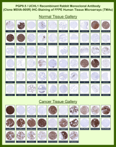 Ubiquitin carboxyl-terminal hydrolase isozyme L1 Rabbit Recombinant Monoclonal Antibody (MSVA-905R) tested on many normal and cancer tissues. The immunohistochemistry staining in these tissues aligns with the expression data in Human Protein Atlas. <br><br>Manual Protocol: Freshly cut sections should be used (less than 10 days between cutting and staining). Heat-induced antigen retrieval for 5 minutes in an autoclave at 121oC in pH 7.8 Target Retrieval Solution buffer. Apply the antibody at a dilution of 1:150 at 37oC for 60 minutes. Visualization of bound antibody by the EnVision Kit (Dako, Agilent) according to the manufacturer's directions.
