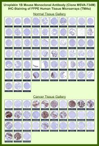 Uroplakin-1b Mouse Monoclonal Antibody (MSVA-734M) tested on many normal and cancer tissues. The immunohistochemistry staining in these tissues aligns with the expression data in Human Protein Atlas. <br><br>Manual Protocol: Freshly cut sections should be used (less than 10 days between cutting and staining). Heat-induced antigen retrieval for 5 minutes in an autoclave at 121oC in pH 7.8 Target Retrieval Solution buffer. Apply the antibody at a dilution of 1:150 at 37oC for 60 minutes. Visualization of bound antibody by the EnVision Kit (Dako, Agilent) according to the manufacturer's directions.