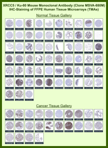 X-ray repair cross-complementing protein 5 Mouse Monoclonal Antibody (MSVA-880M) tested on many normal and cancer tissues. The immunohistochemistry staining in these tissues aligns with the expression data in Human Protein Atlas. <br><br>Manual Protocol: Freshly cut sections should be used (less than 10 days between cutting and staining). Heat-induced antigen retrieval for 5 minutes in an autoclave at 121oC in pH 7.8 Target Retrieval Solution buffer. Apply the antibody at a dilution of 1:150 at 37oC for 60 minutes. Visualization of bound antibody by the EnVision Kit (Dako, Agilent) according to the manufacturer's directions.
