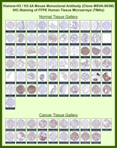 Histone H3.1 Mouse Recombinant Monoclonal Antibody (MSVA-903M) tested on many normal and cancer tissues. The immunohistochemistry staining in these tissues aligns with the expression data in Human Protein Atlas. <br><br>Manual Protocol: Freshly cut sections should be used (less than 10 days between cutting and staining). Heat-induced antigen retrieval for 5 minutes in an autoclave at 121oC in pH 7.8 Target Retrieval Solution buffer. Apply the antibody at a dilution of 1:150 at 37oC for 60 minutes. Visualization of bound antibody by the EnVision Kit (Dako, Agilent) according to the manufacturer's directions.