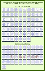 Solute carrier family 45 member 3 Rabbit Recombinant Monoclonal Antibody (MSVA-460R) tested on many normal and cancer tissues. The immunohistochemistry staining in these tissues aligns with the expression data in Human Protein Atlas. <br><br>Manual Protocol: Freshly cut sections should be used (less than 10 days between cutting and staining). Heat-induced antigen retrieval for 5 minutes in an autoclave at 121oC in pH 7.8 Target Retrieval Solution buffer. Apply the antibody at a dilution of 1:150 at 37oC for 60 minutes. Visualization of bound antibody by the EnVision Kit (Dako, Agilent) according to the manufacturer's directions.