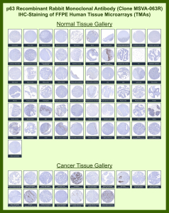 Tumor protein 63 Rabbit Recombinant Monoclonal Antibody (MSVA-063R) tested on many normal and cancer tissues. The immunohistochemistry staining in these tissues aligns with the expression data in Human Protein Atlas. <br><br>Manual Protocol: Freshly cut sections should be used (less than 10 days between cutting and staining). Heat-induced antigen retrieval for 5 minutes in an autoclave at 121oC in pH 7.8 Target Retrieval Solution buffer. Apply the antibody at a dilution of 1:150 at 37oC for 60 minutes. Visualization of bound antibody by the EnVision Kit (Dako, Agilent) according to the manufacturer's directions.