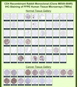 T-cell surface glycoprotein CD4 Rabbit Recombinant Monoclonal Antibody (MSVA-004R) tested on many normal and cancer tissues. The immunohistochemistry staining in these tissues aligns with the expression data in Human Protein Atlas. <br><br>Manual Protocol: Freshly cut sections should be used (less than 10 days between cutting and staining). Heat-induced antigen retrieval for 5 minutes in an autoclave at 121oC in pH 7.8 Target Retrieval Solution buffer. Apply the antibody at a dilution of 1:150 at 37oC for 60 minutes. Visualization of bound antibody by the EnVision Kit (Dako, Agilent) according to the manufacturer's directions.