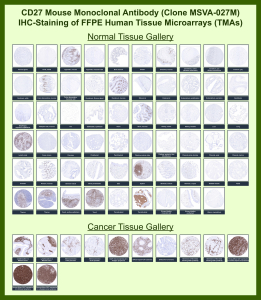 Immunohistochemistry analysis of CD27 for IHC Antibody in FFPE human tissue microarrays (TMAs). CD27 Antibody (clone MSVA-027M) demonstrates membranous HRP-DAB brown staining in lymphocyte-rich tissues including tonsil, lymph node, spleen, and thymus, consistent with CD27 expression on activated and memory T and B lymphocytes. Most non-lymphoid tissues show absent or minimal staining, supporting expected tissue-restricted expression. In cancer tissue arrays, CD27-positive tumor-infiltrating lymphocytes are observed in multiple malignancies, while strong staining is seen in lymphoid neoplasms consistent with B-cell lineage origin. The overall immunohistochemical pattern aligns with publicly available expression profiles, including data reported in the Human Protein Atlas.