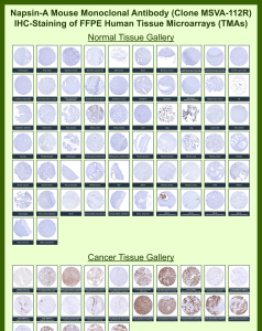 Napsin-A Rabbit Recombinant Monoclonal Antibody (MSVA-112R) tested on many normal and cancer tissues. The immunohistochemistry staining in these tissues aligns with the expression data in Human Protein Atlas. <br><br>Manual Protocol: Freshly cut sections should be used (less than 10 days between cutting and staining). Heat-induced antigen retrieval for 5 minutes in an autoclave at 121oC in pH 7.8 Target Retrieval Solution buffer. Apply the antibody at a dilution of 1:150 at 37oC for 60 minutes. Visualization of bound antibody by the EnVision Kit (Dako, Agilent) according to the manufacturer's directions.
