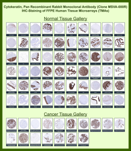 Keratin, type II cytoskeletal 1b Rabbit Recombinant Monoclonal Antibody (MSVA-000R) tested on many normal and cancer tissues. The immunohistochemistry staining in these tissues aligns with the expression data in Human Protein Atlas. <br><br>Manual Protocol: Freshly cut sections should be used (less than 10 days between cutting and staining). Heat-induced antigen retrieval for 5 minutes in an autoclave at 121oC in pH 7.8 Target Retrieval Solution buffer. Apply the antibody at a dilution of 1:150 at 37oC for 60 minutes. Visualization of bound antibody by the EnVision Kit (Dako, Agilent) according to the manufacturer's directions.