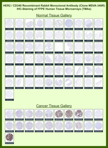 Immunohistochemistry overview of HER2 expression in human tissue microarrays. Formalin-fixed, paraffin-embedded human tissue microarrays stained with HER2 antibody (clone MSVA-340R) show minimal to absent staining across the majority of normal tissues, while variable membranous staining is observed in selected epithelial tumor samples, most prominently within subsets of breast and gastric carcinoma cores. Normal tissue cores display little to no specific signal under the conditions tested, consistent with restricted expression of Erb-B2 receptor tyrosine kinase 2 in non-malignant tissues. Antigen retrieval was performed using heat-induced epitope retrieval prior to immunostaining, followed by chromogenic detection.<BR>Manual Protocol: Freshly cut sections should be used (less than 10 days between cutting and staining). Heat-induced antigen retrieval for 5 minutes in an autoclave at 121oC in pH 7.8 Target Retrieval Solution buffer. Apply the antibody at a dilution of 1:150 at 37oC for 60 minutes. Visualization of bound antibody by the EnVision Kit (Dako, Agilent) according to the manufacturer's directions.